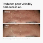 The Ordinary Niacinamide 10% + Zinc 1% - Image 2